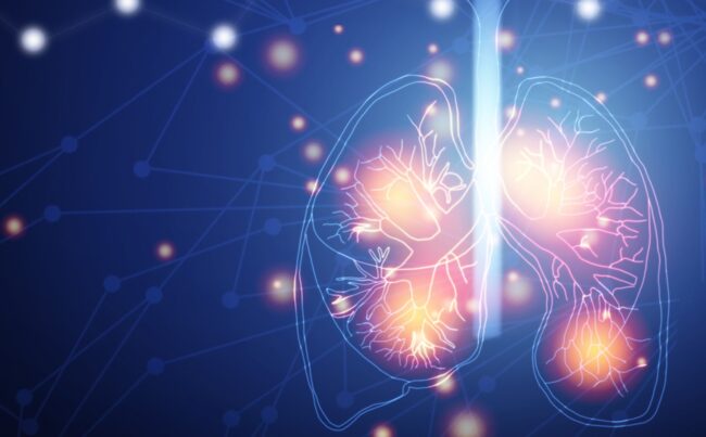 Akciğer Tümörleri