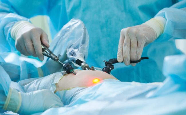 akciğer kanseri vats akciğer kanseri vats